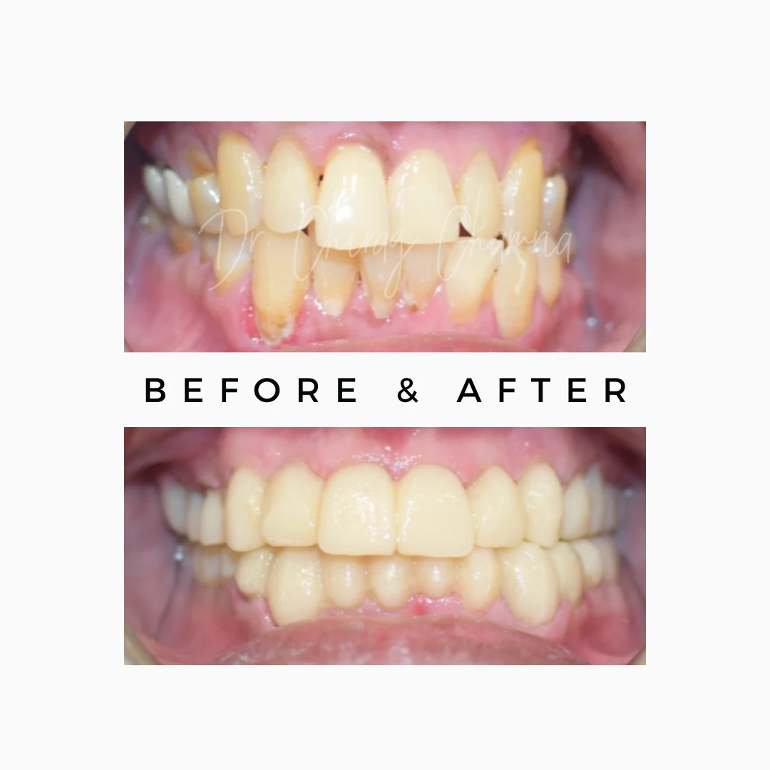 Dental Clinic in Mumbai | Royal Dental Clinics 4 Smile Makeover
