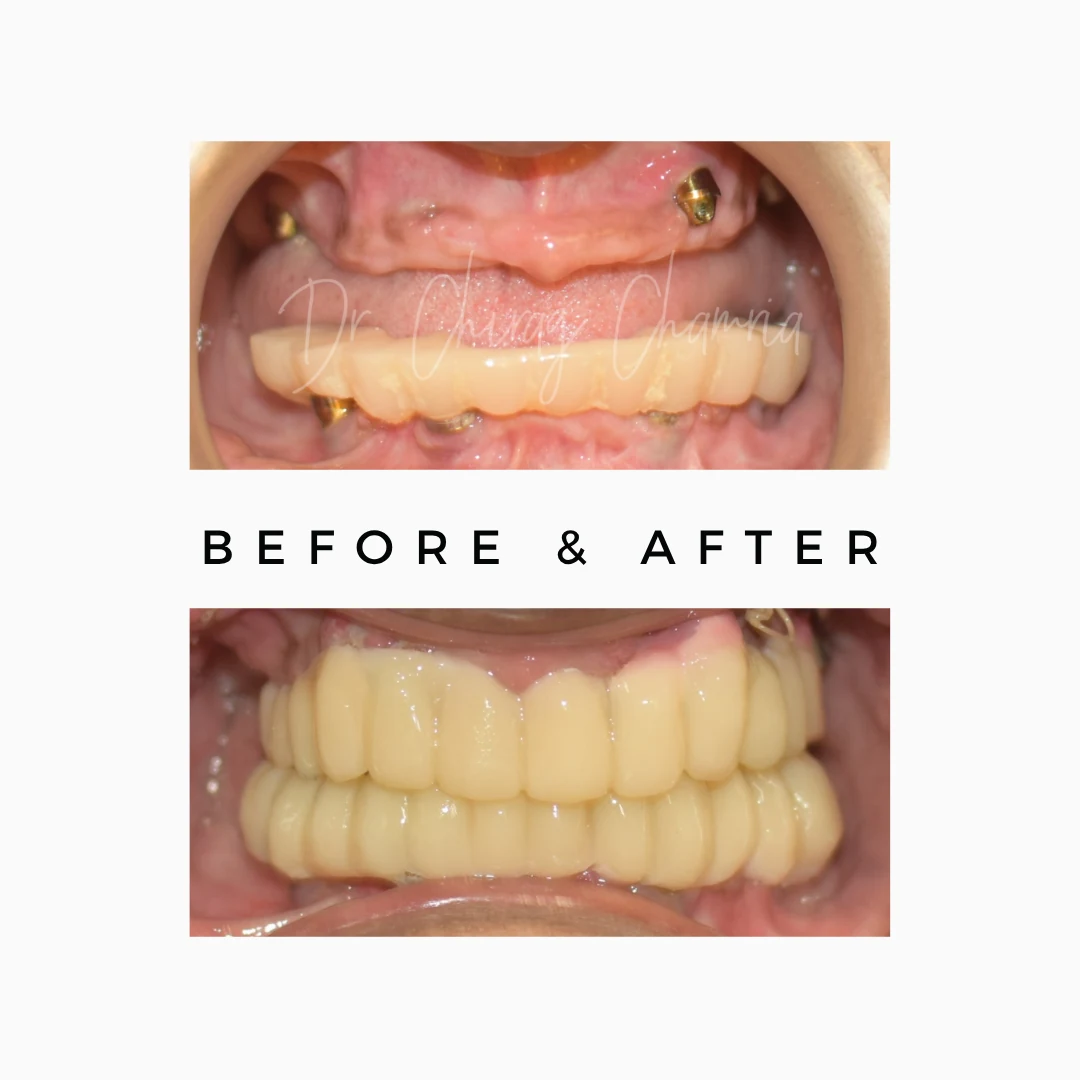 Oral & Maxillofacial Surgery