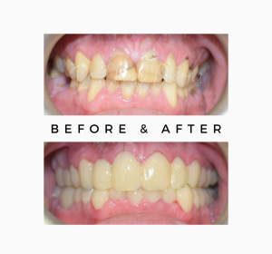 Cosmetic Dentistry